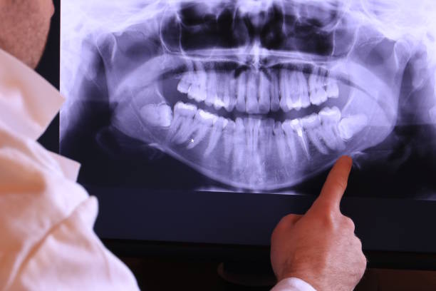 Best Dentist for Tooth Abscess  in Salem Heights, OH