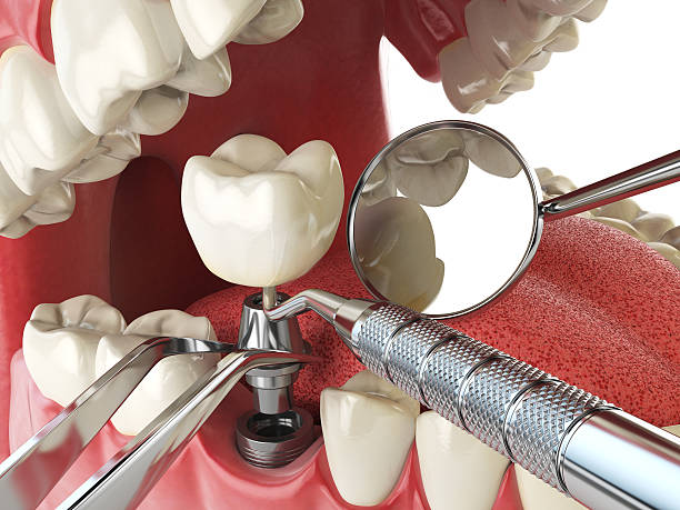 Best Emergency Gum Pain Relief  in Salem Heights, OH
